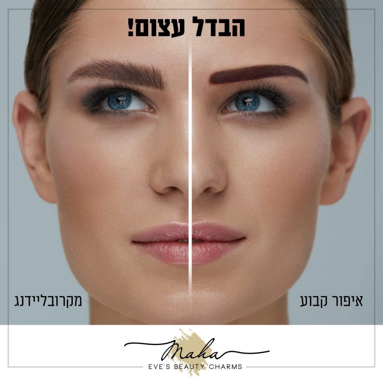 הבדל עצום